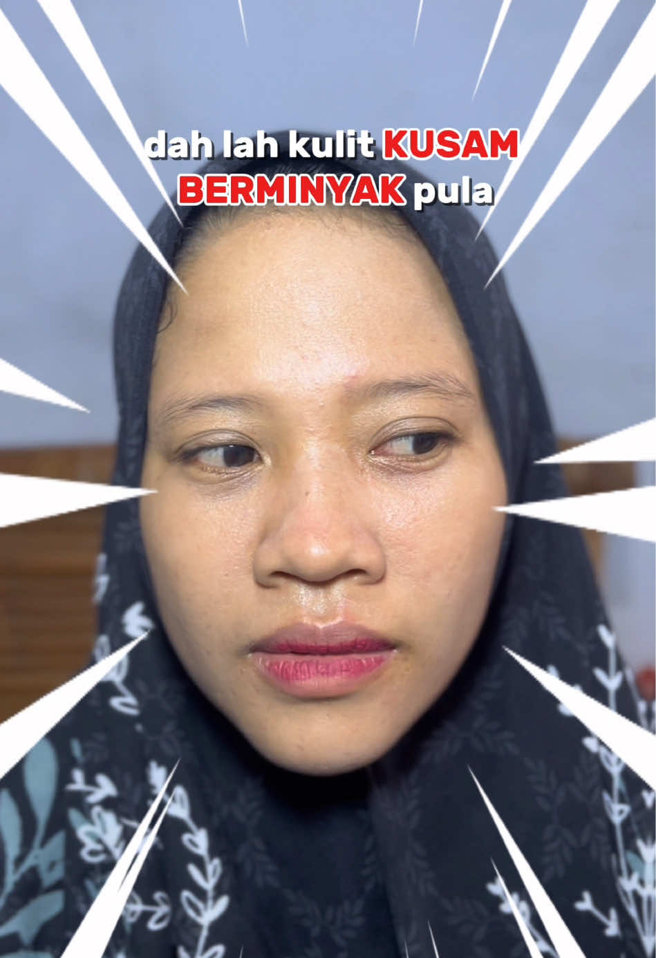 @Mervably Skin