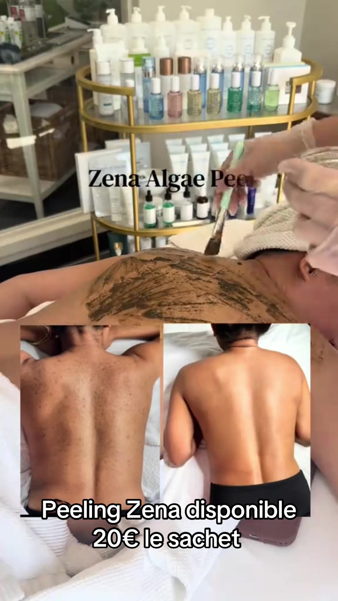 @peeling_zena