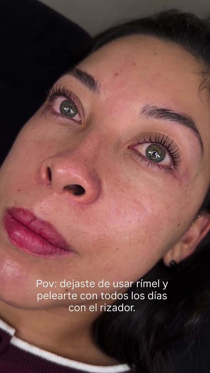 @CherryBomb