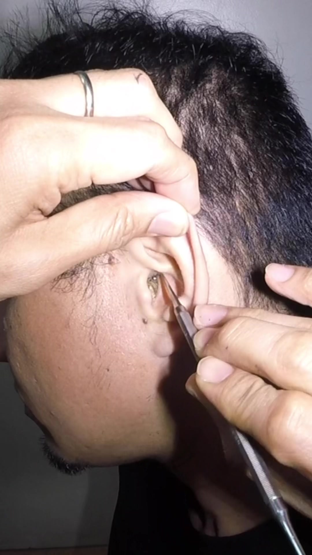 @TheEarwaxSpecialist