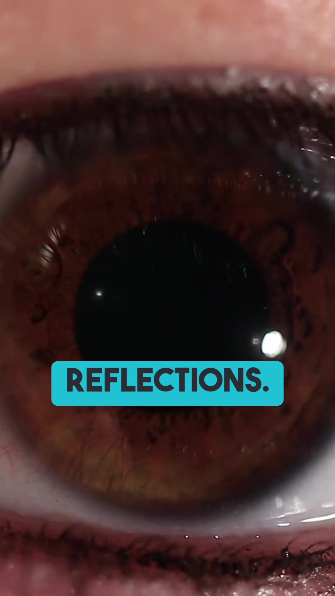 @Pure Vision Queens