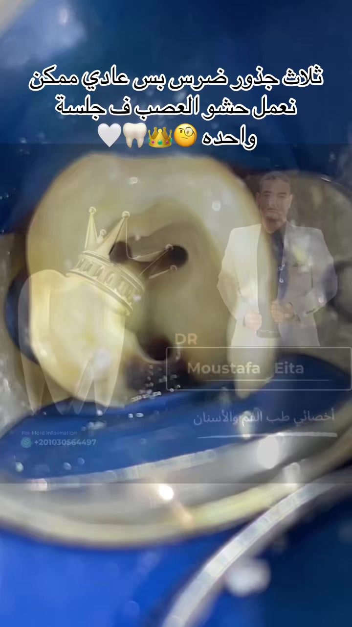 @Dr Mostafa Eita