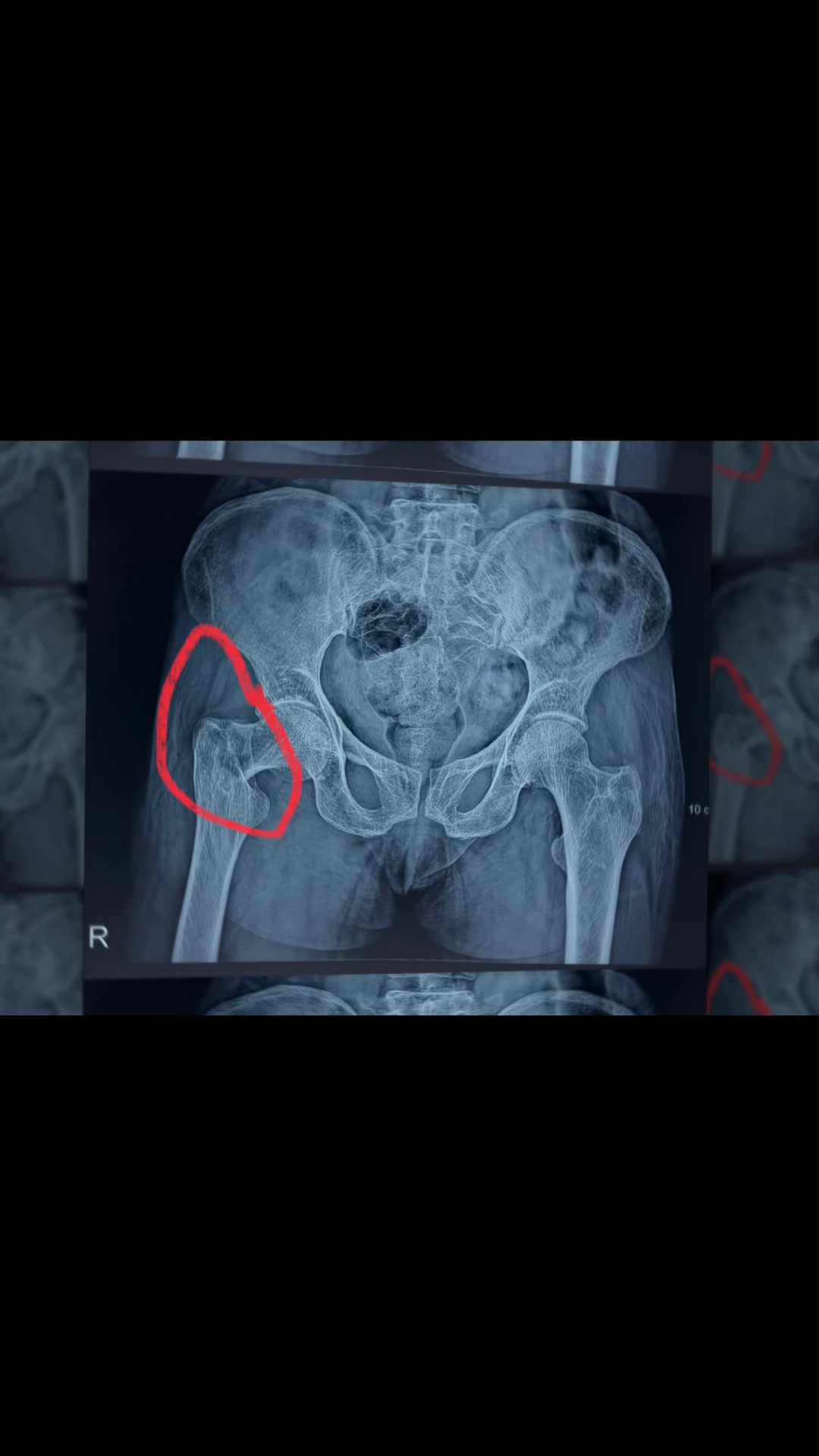 @Spine_Ortho_Surgeon_Arbind