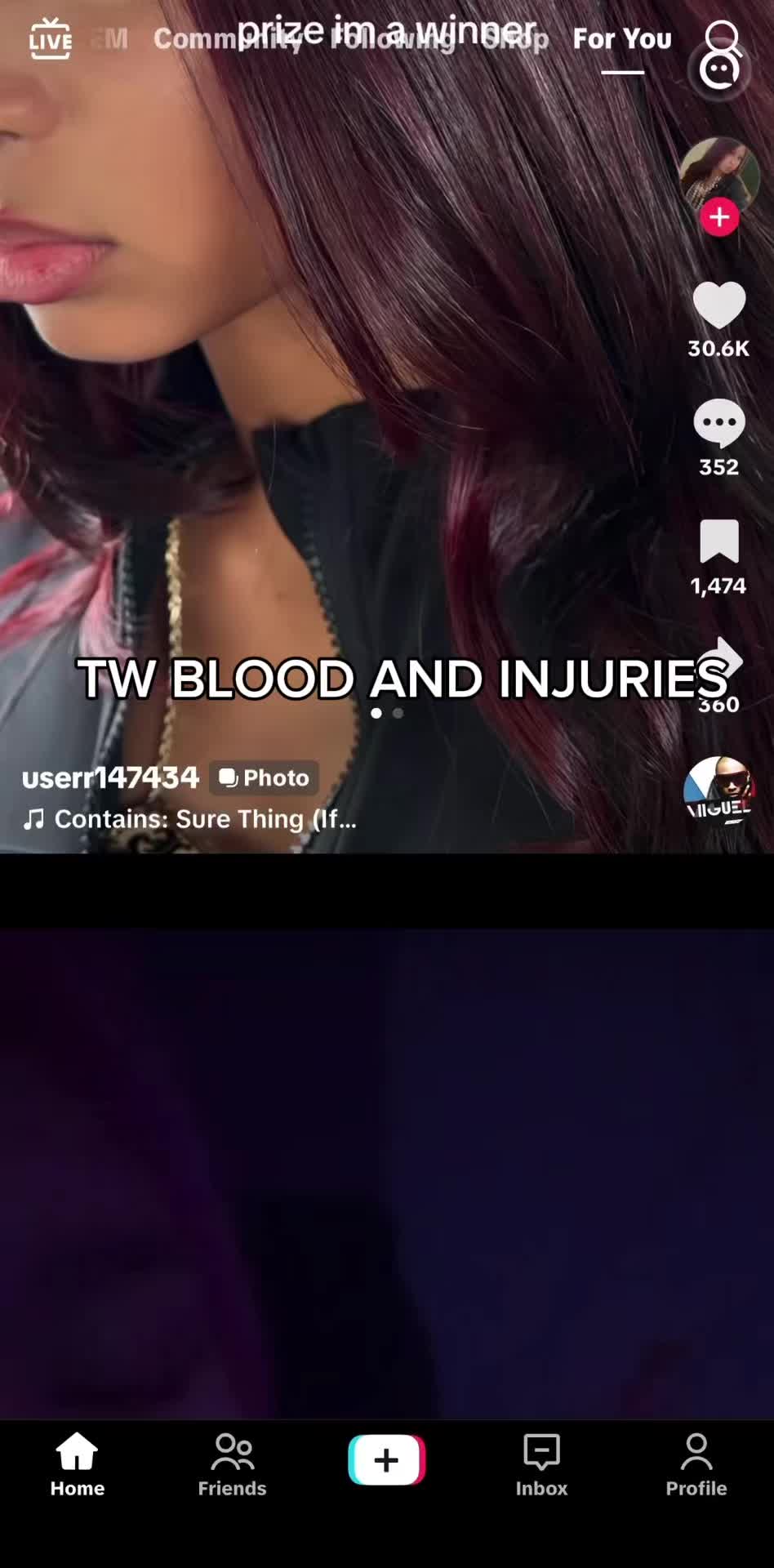 @Zo
