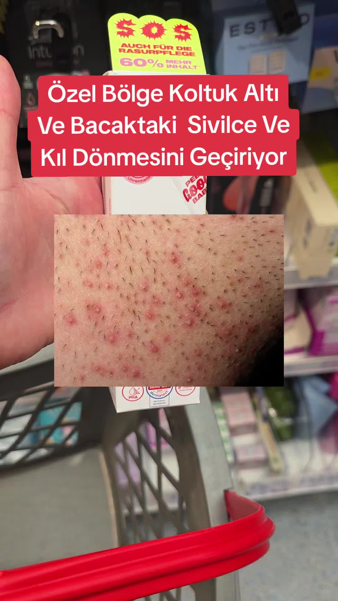 @Gurbet Ana