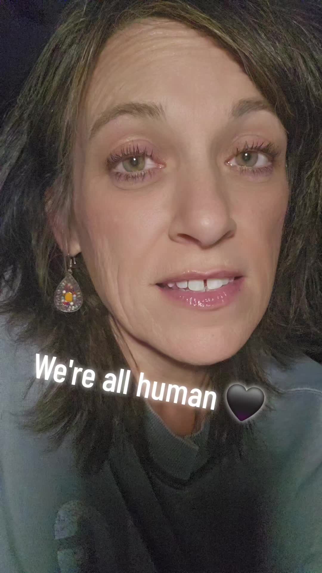 @Fox7997