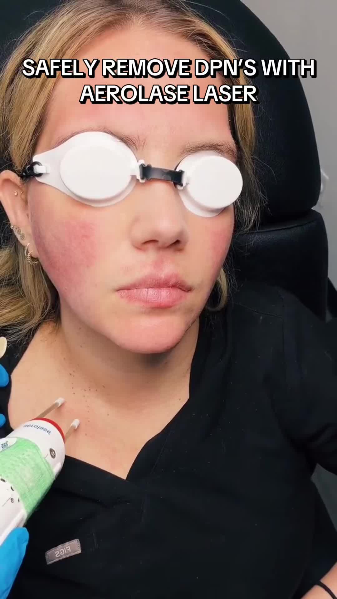 @Botox Filler Skin Los Angeles