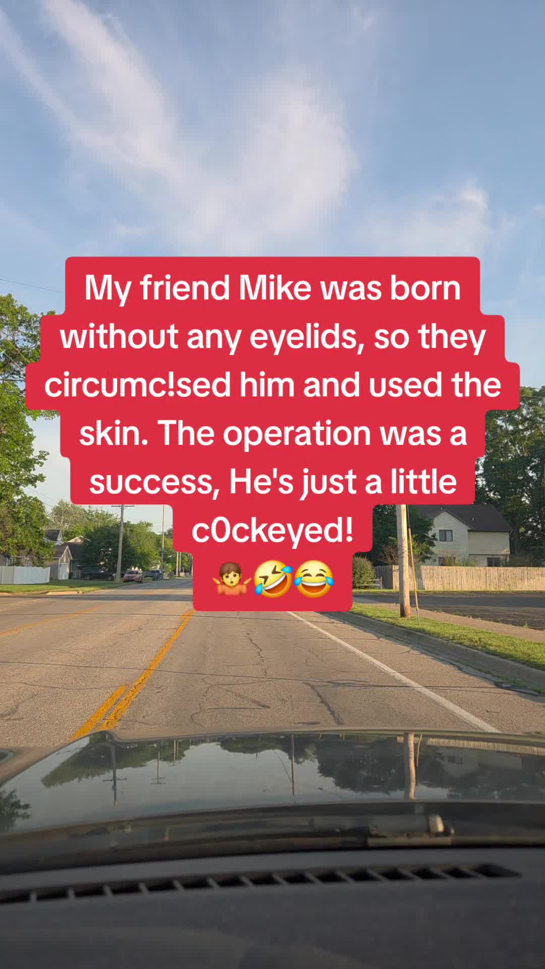 @hillbillybonz