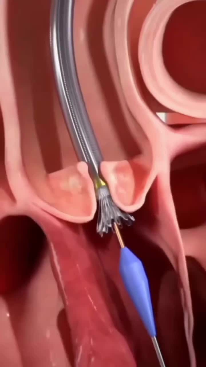 @Fernando Vieira