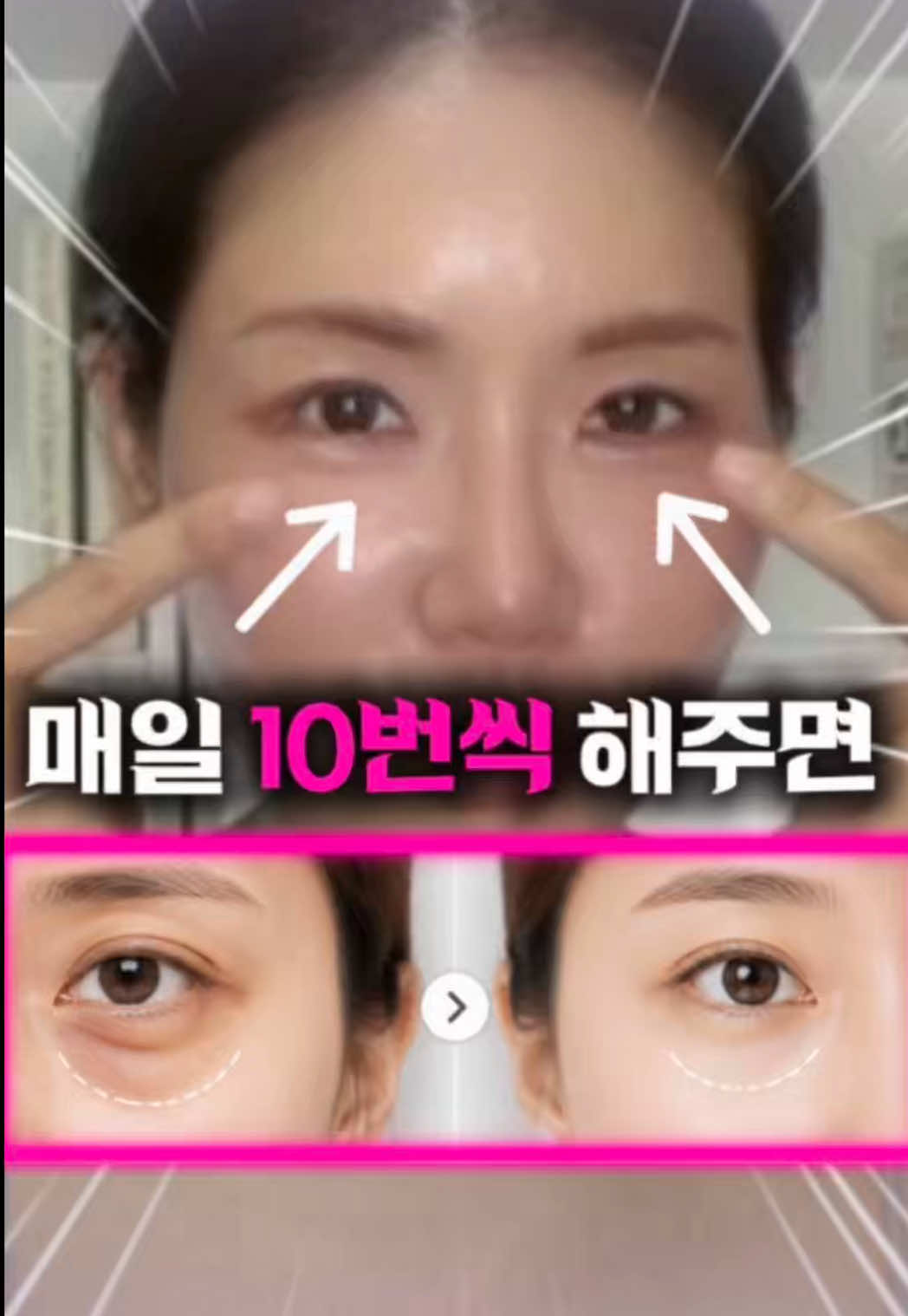 @지나스 GINAS