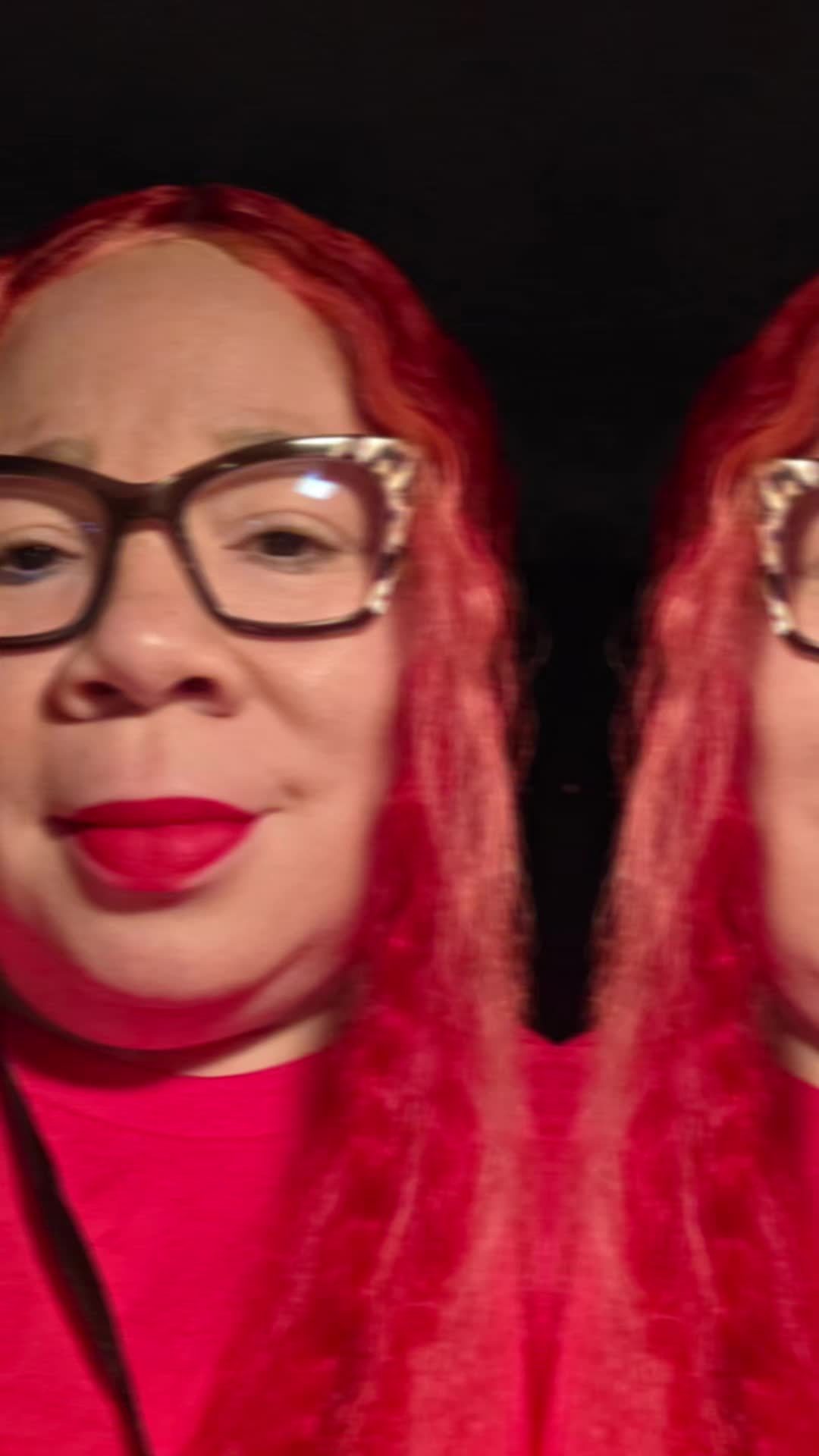 @Miss. PinkY(vitiligo girl)