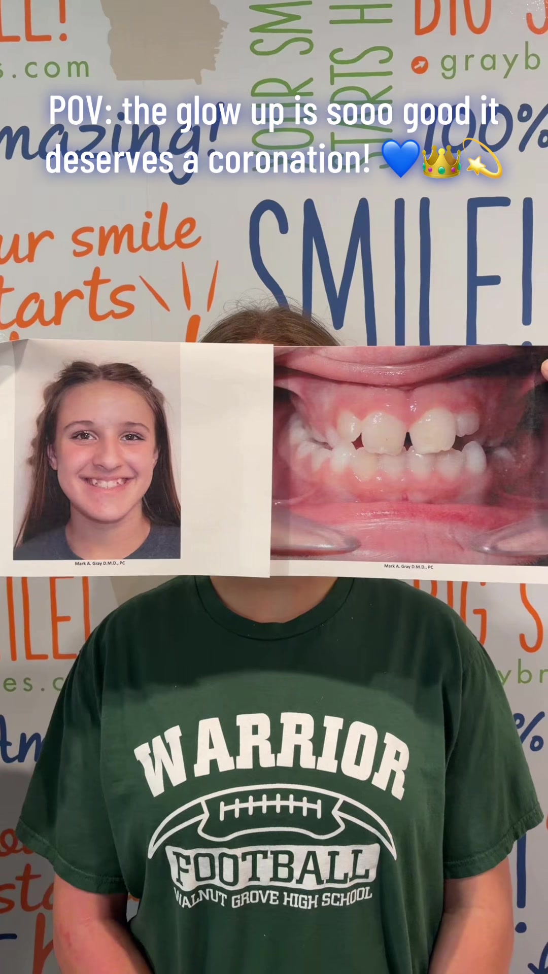 @graybraces
