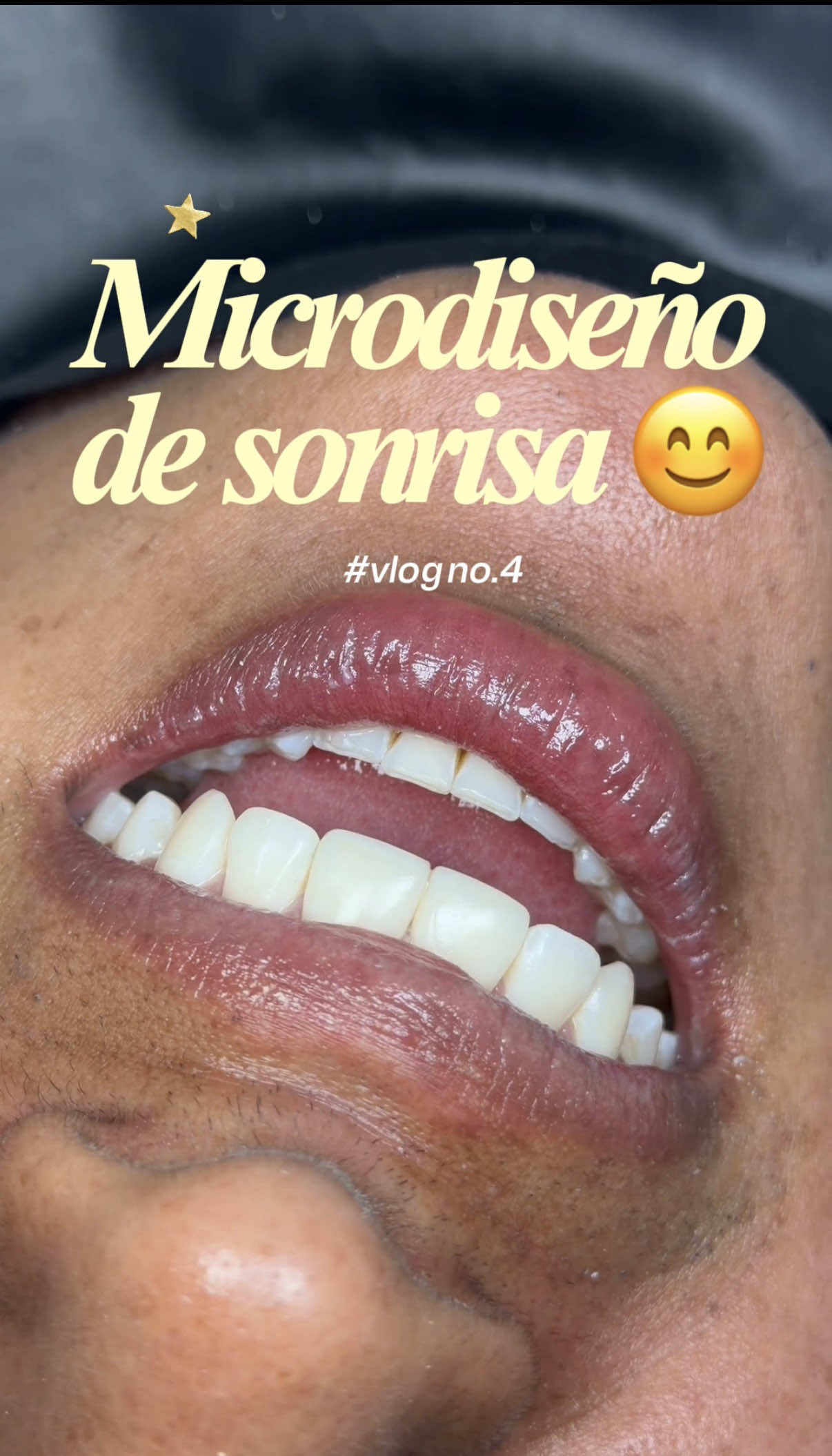 @Cava Cl&iacute;nica Dental 🦷