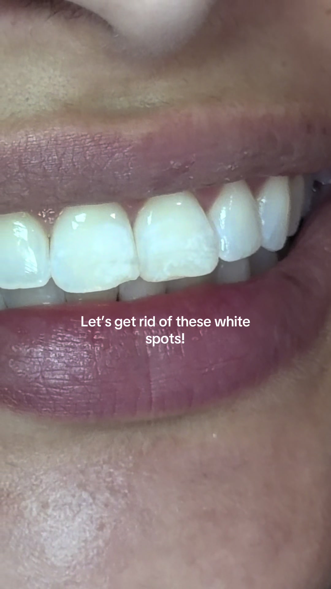 @Hello Dental