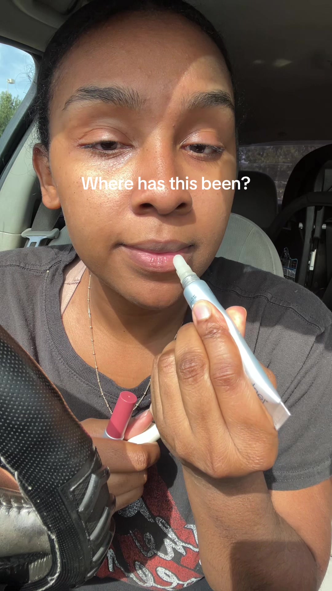 @Ally