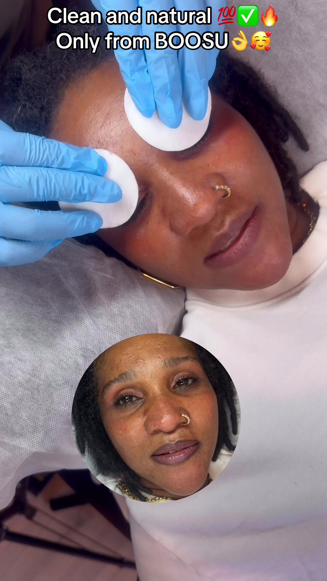 @@Boosu_33skintreatment