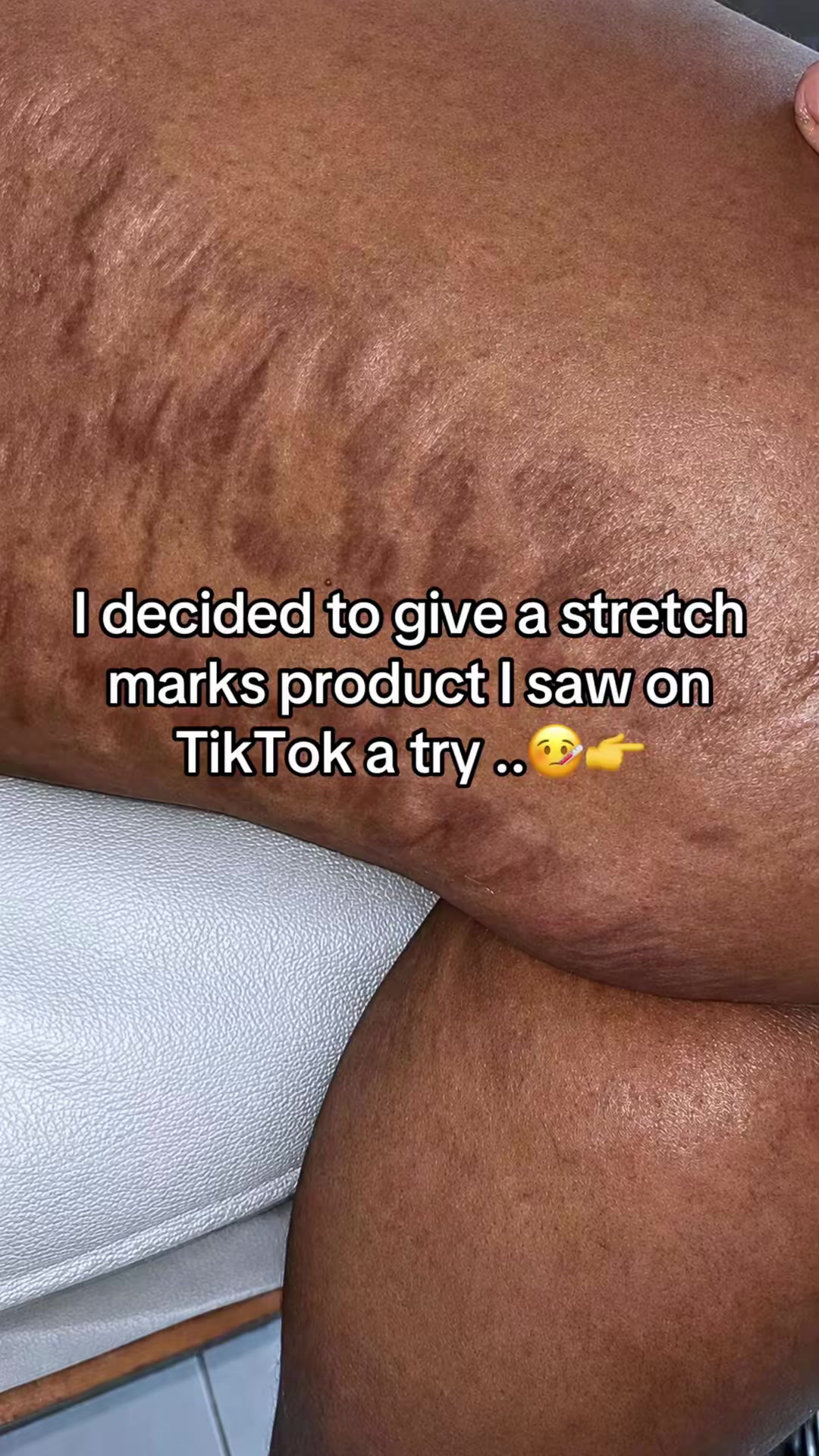@Radiant skin