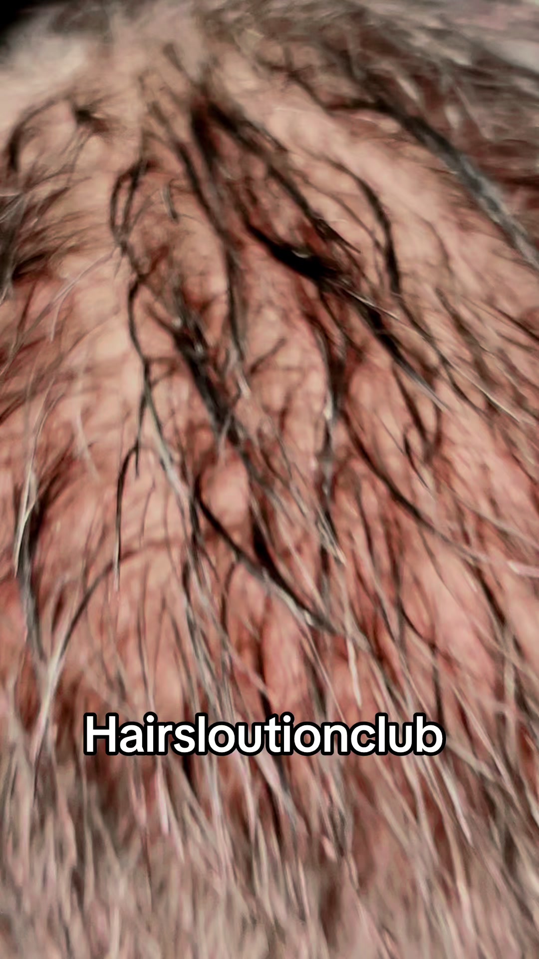 @hairsolutionclub9✅