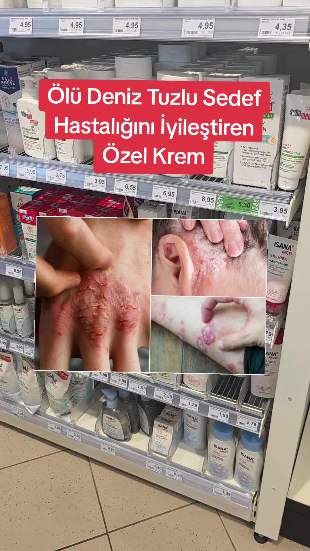 @Gurbetana27