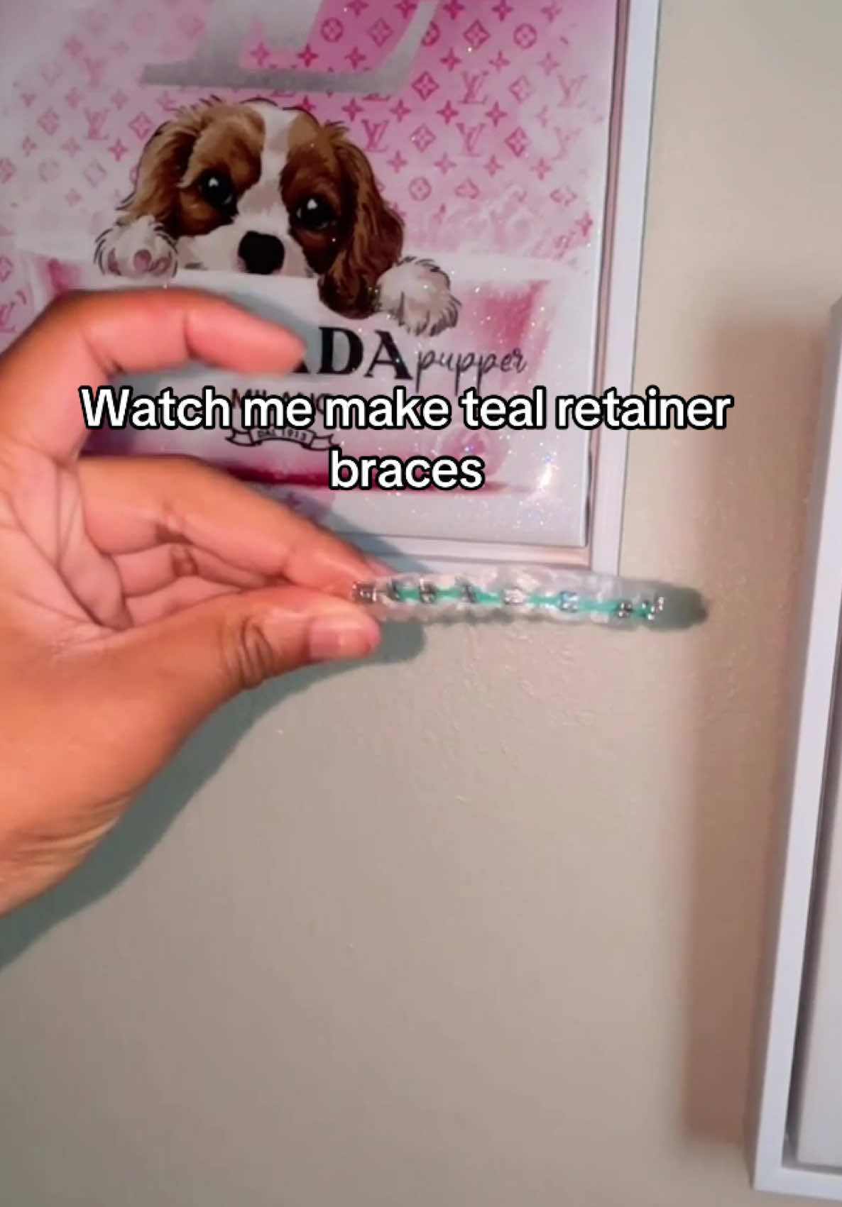 @THE FASHION BRACES GIRL🫧 🦷