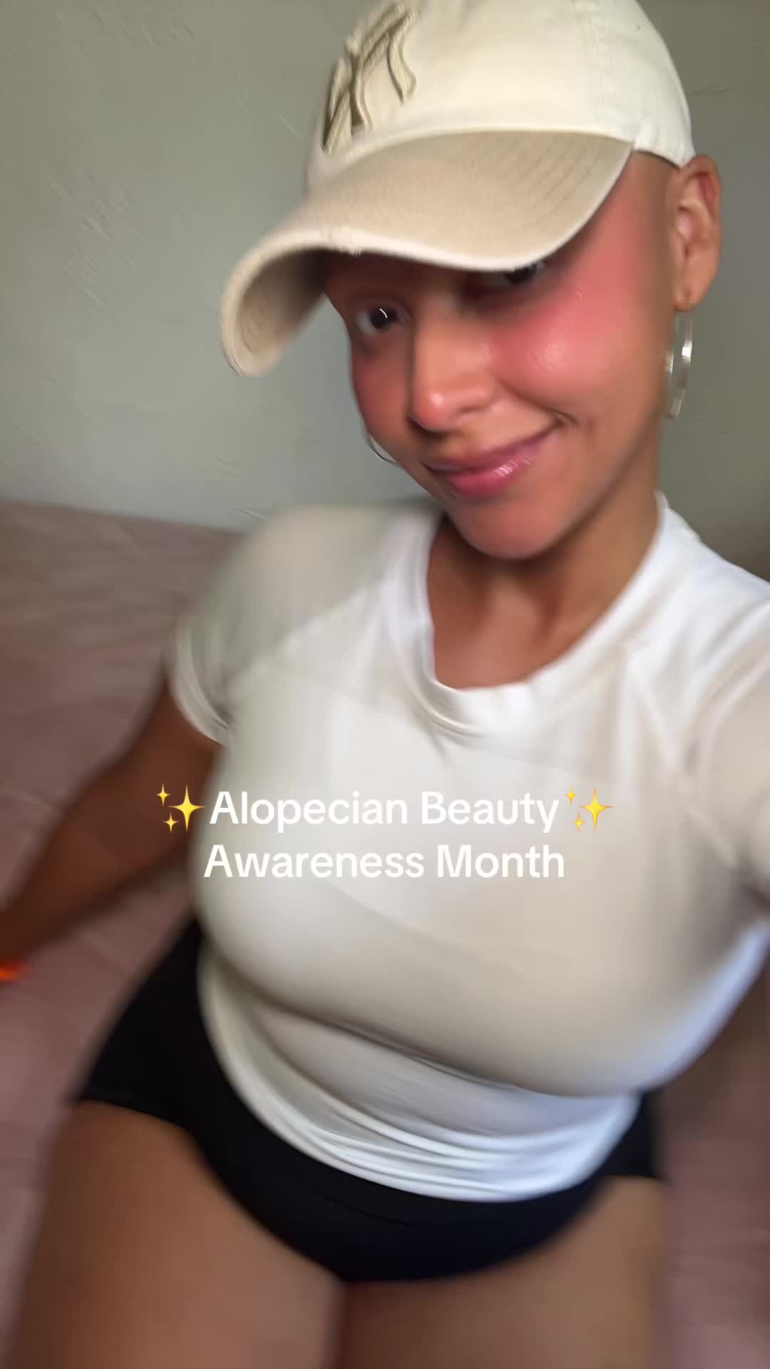 @AlopecianPrincess