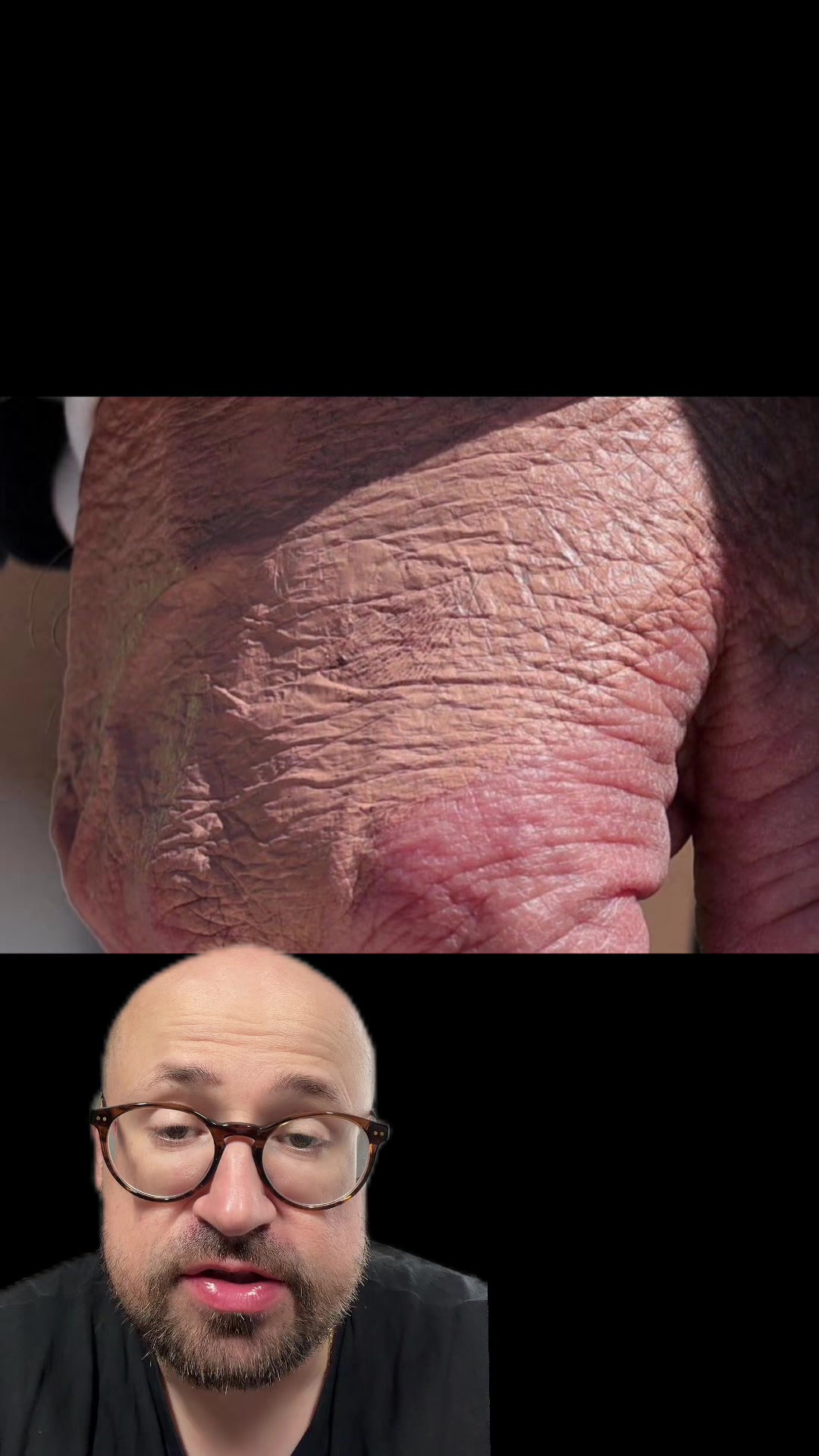 @Weź Tabletkę