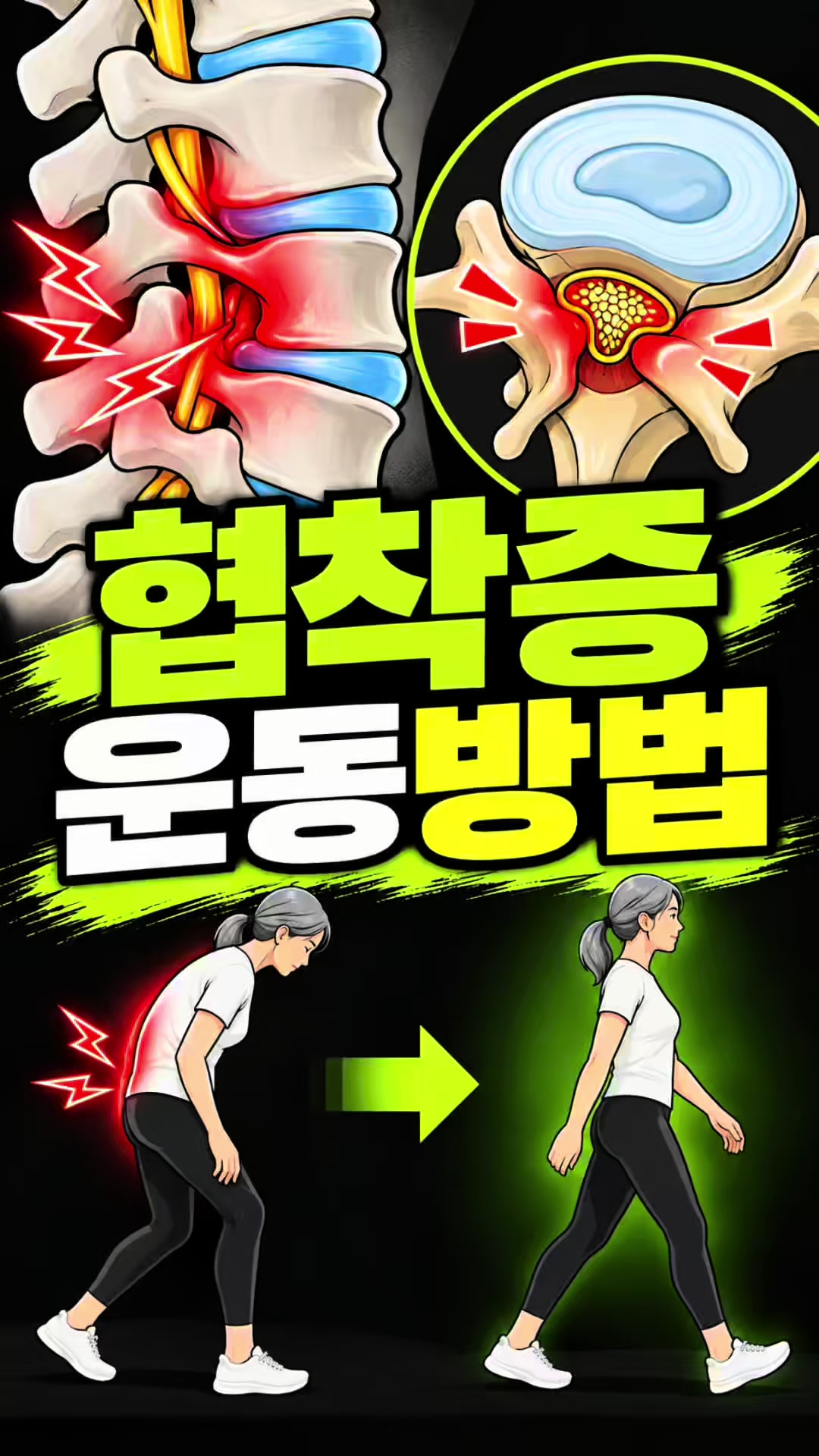 @재활운동촤이