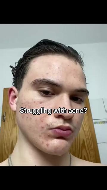 @Andolo
