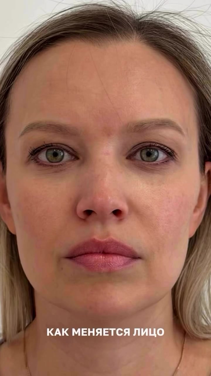 @Dr.milevskaya
