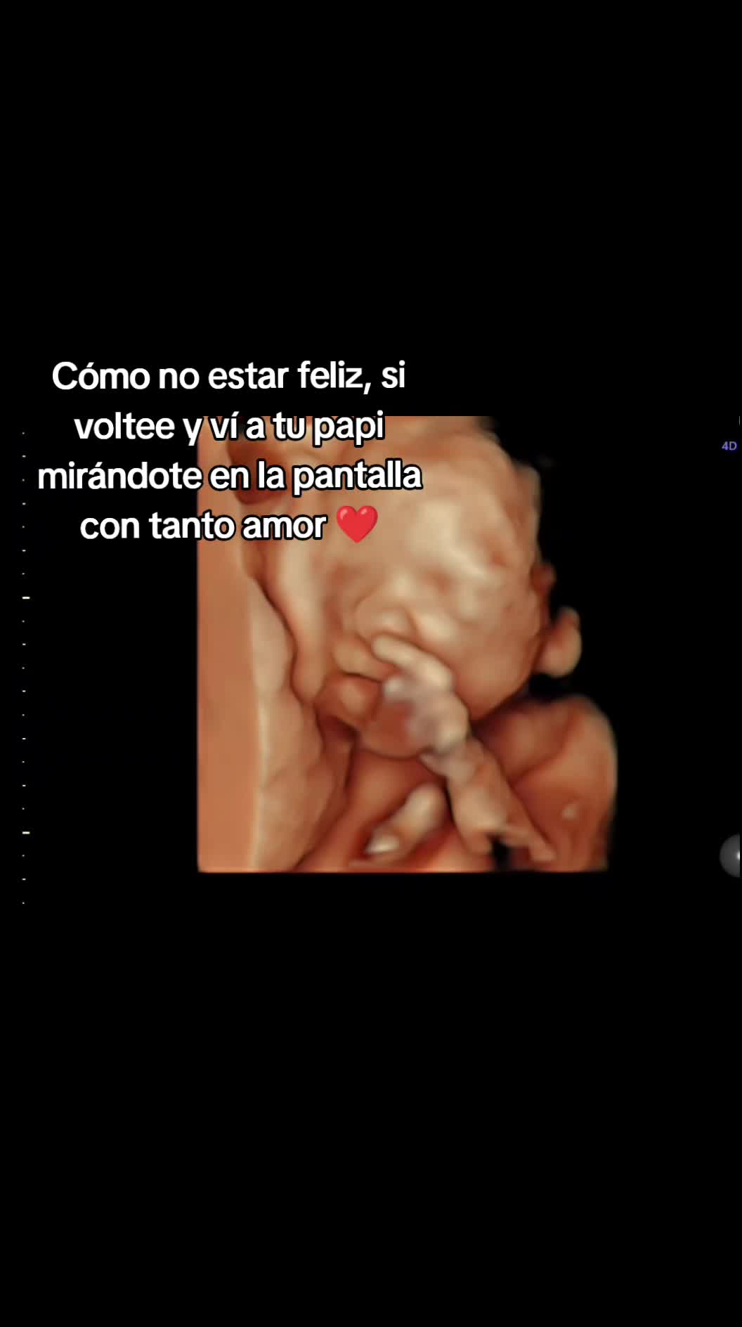 @Luna Rumpels