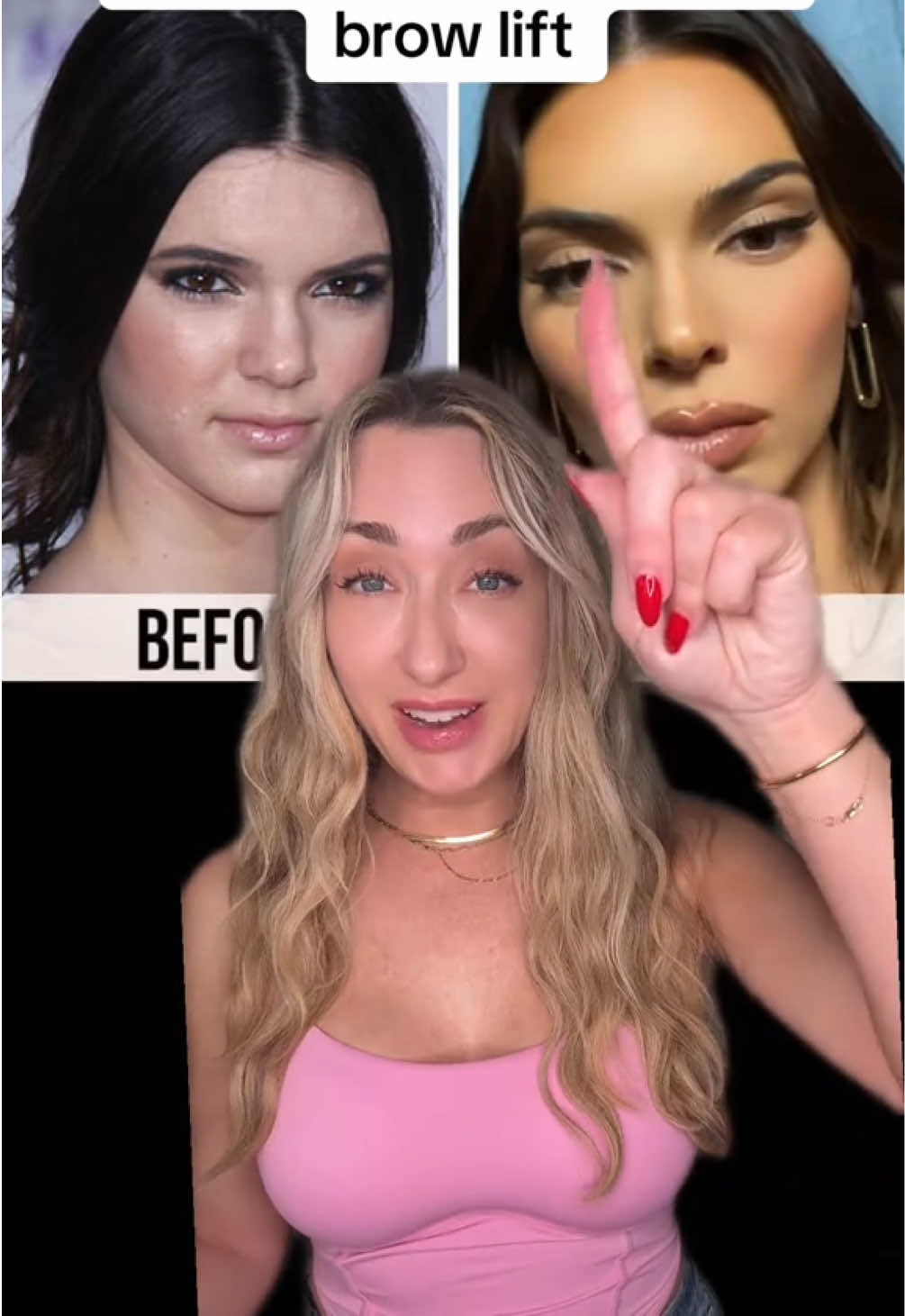 @Nicole Smith Cosmetic Injector