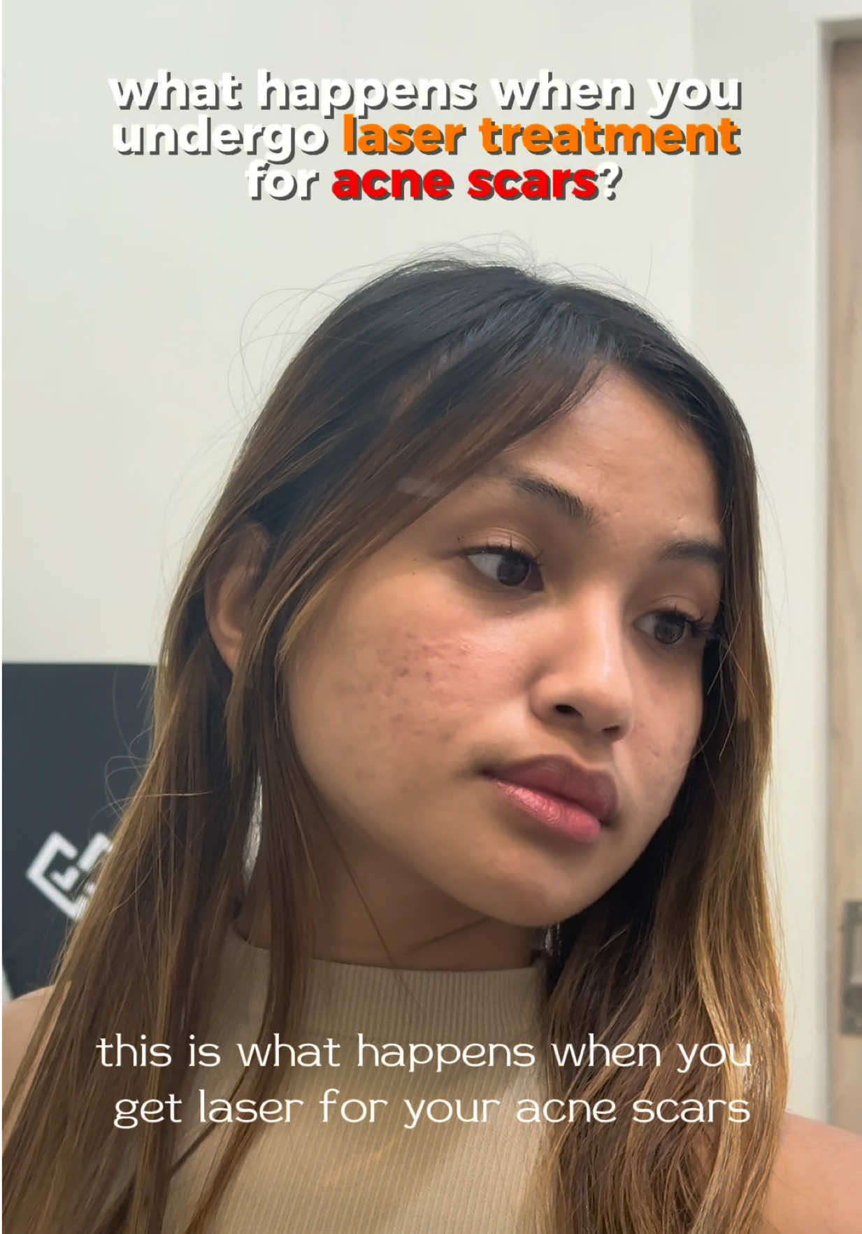 @Erika