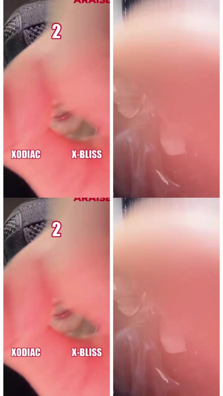 @Rinbay123