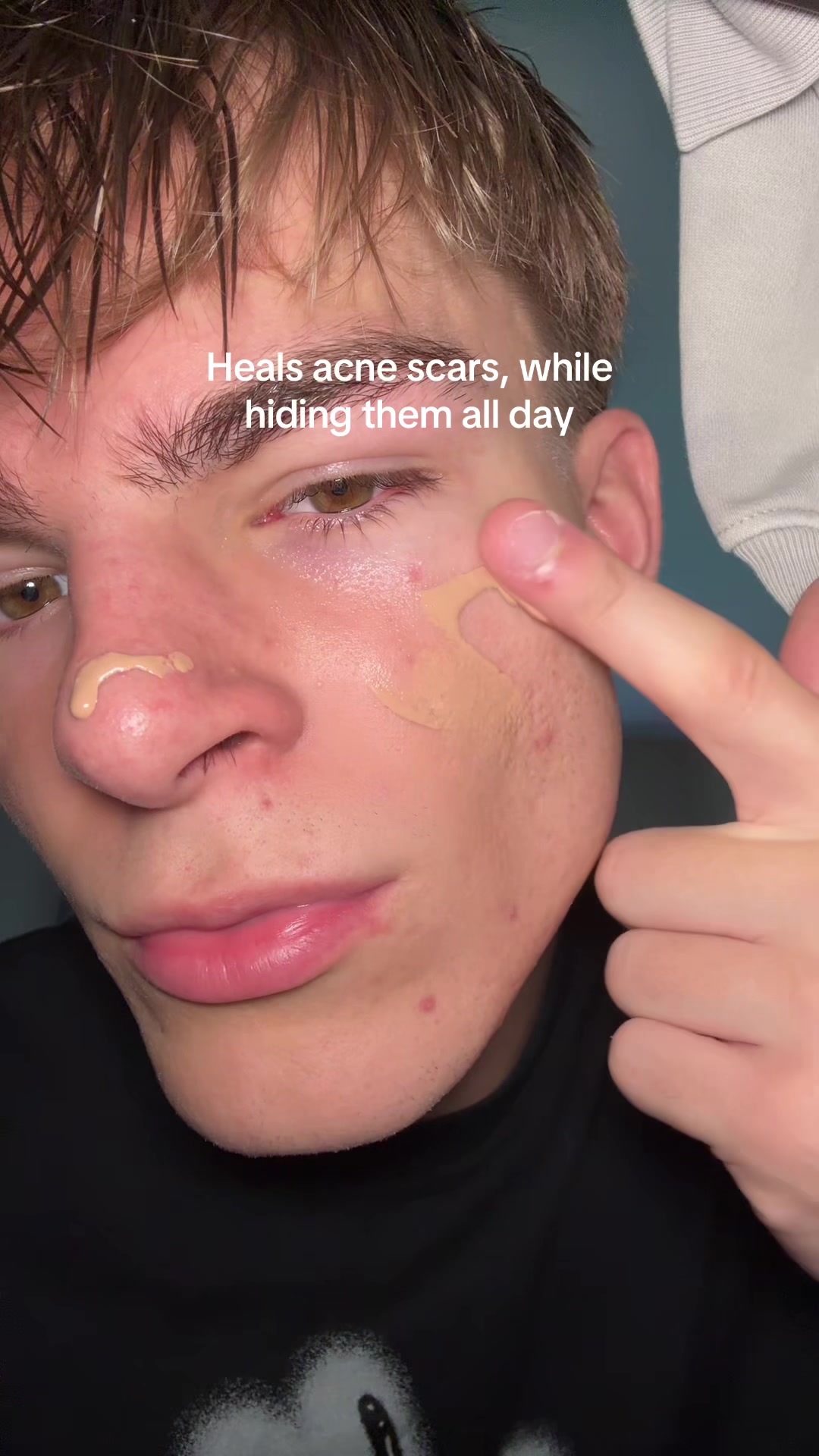 @Finn