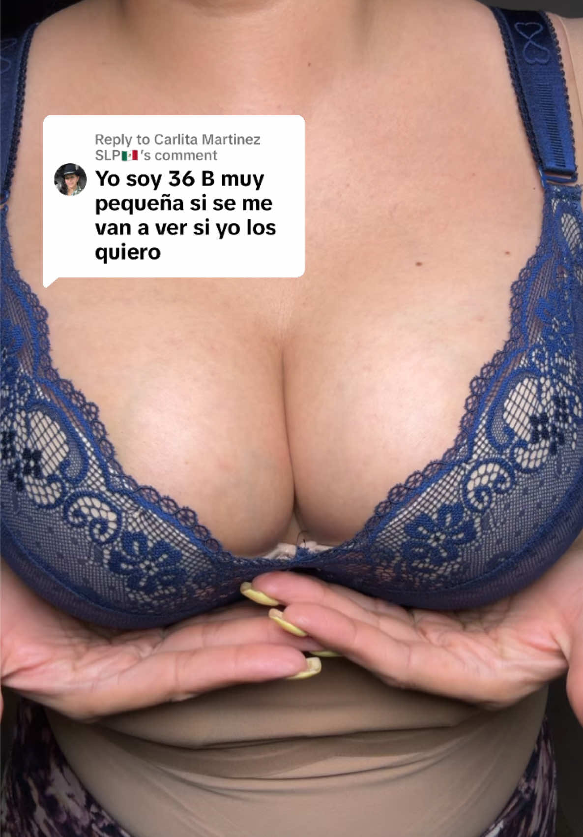 @Lizeth Ochoa