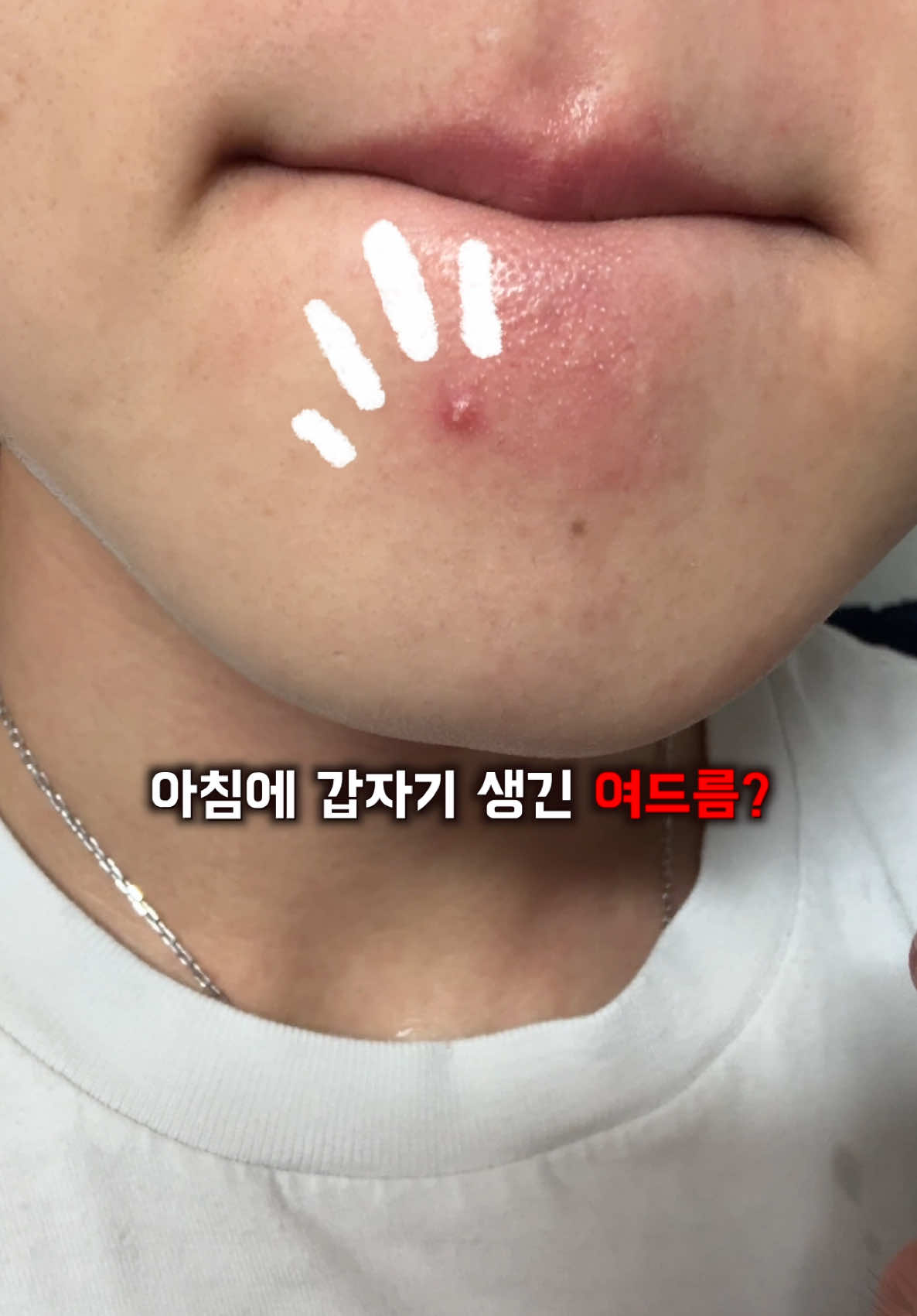 @털털이 TTE