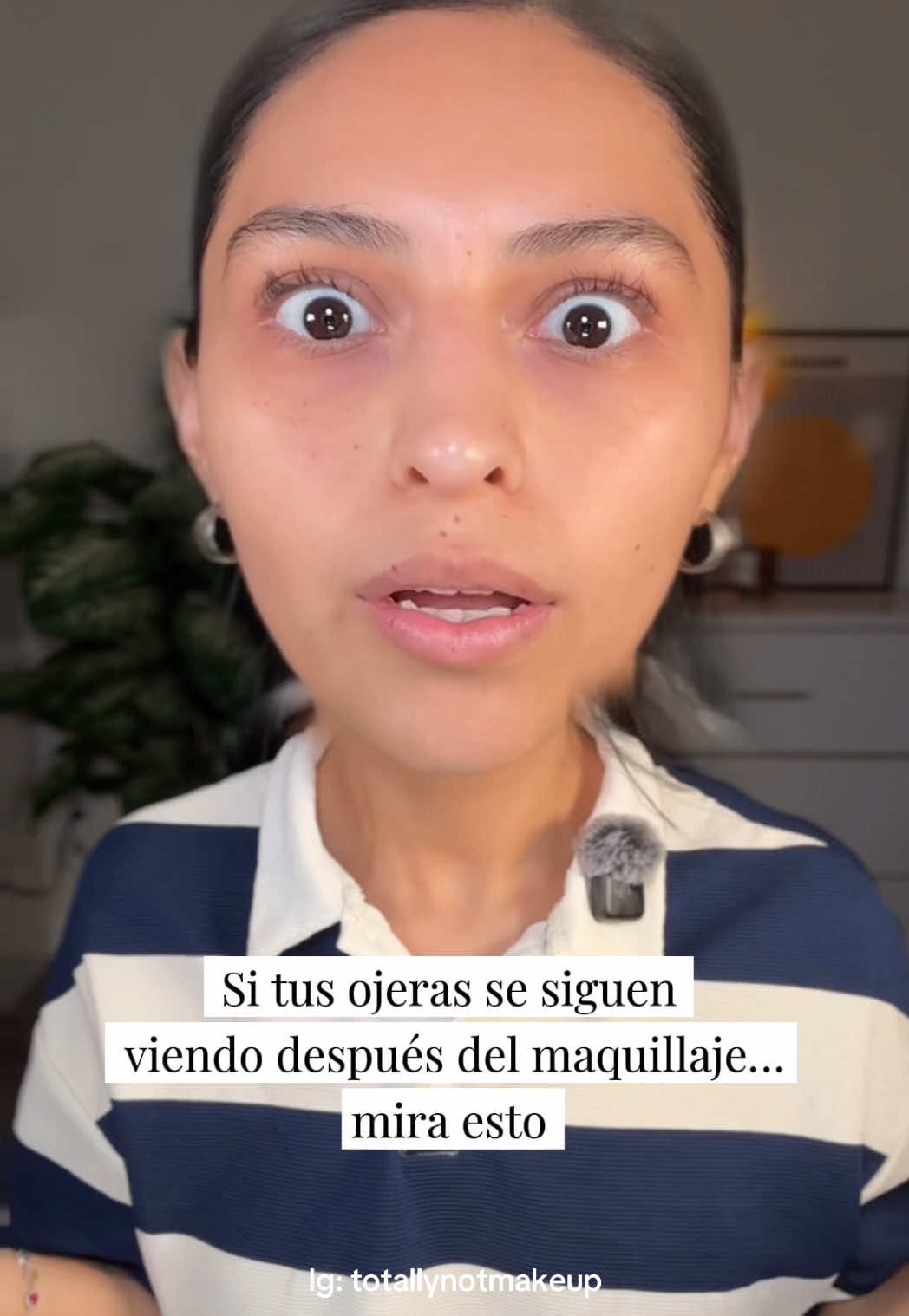 @Nani