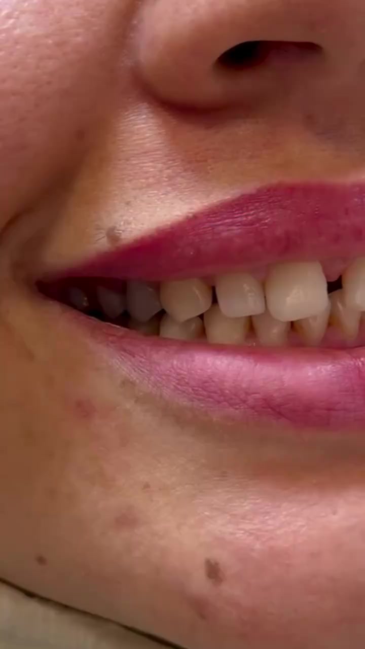 @Dr.Naasir🦷🩵🩺