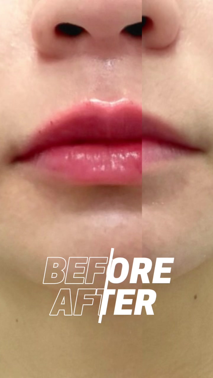 @AdvancedDermatology661
