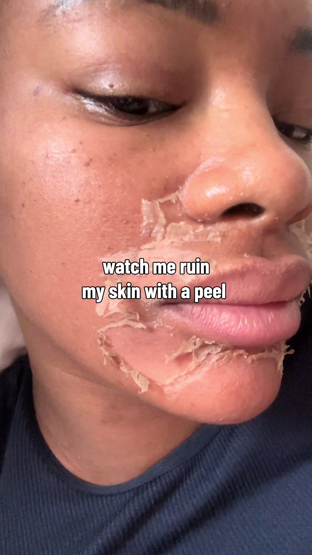 @Sarah Ford Skin