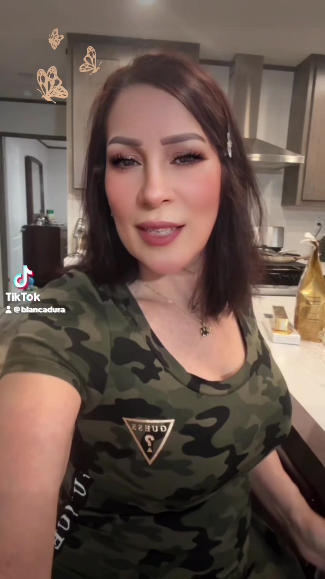 @🎀blankita💝de Chihuahua 🎀
