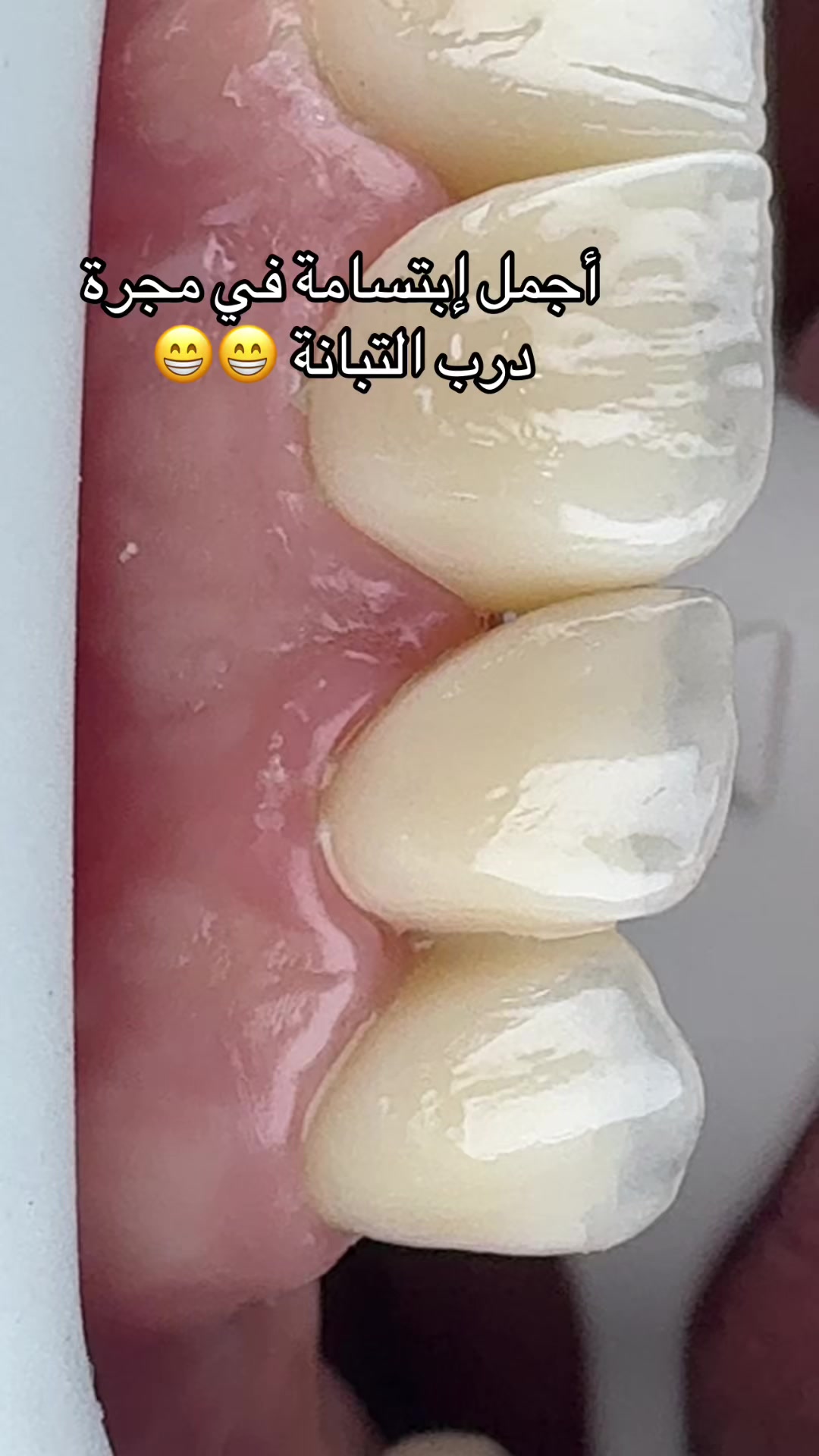 @GOSMILE ROUIBA🇩🇿