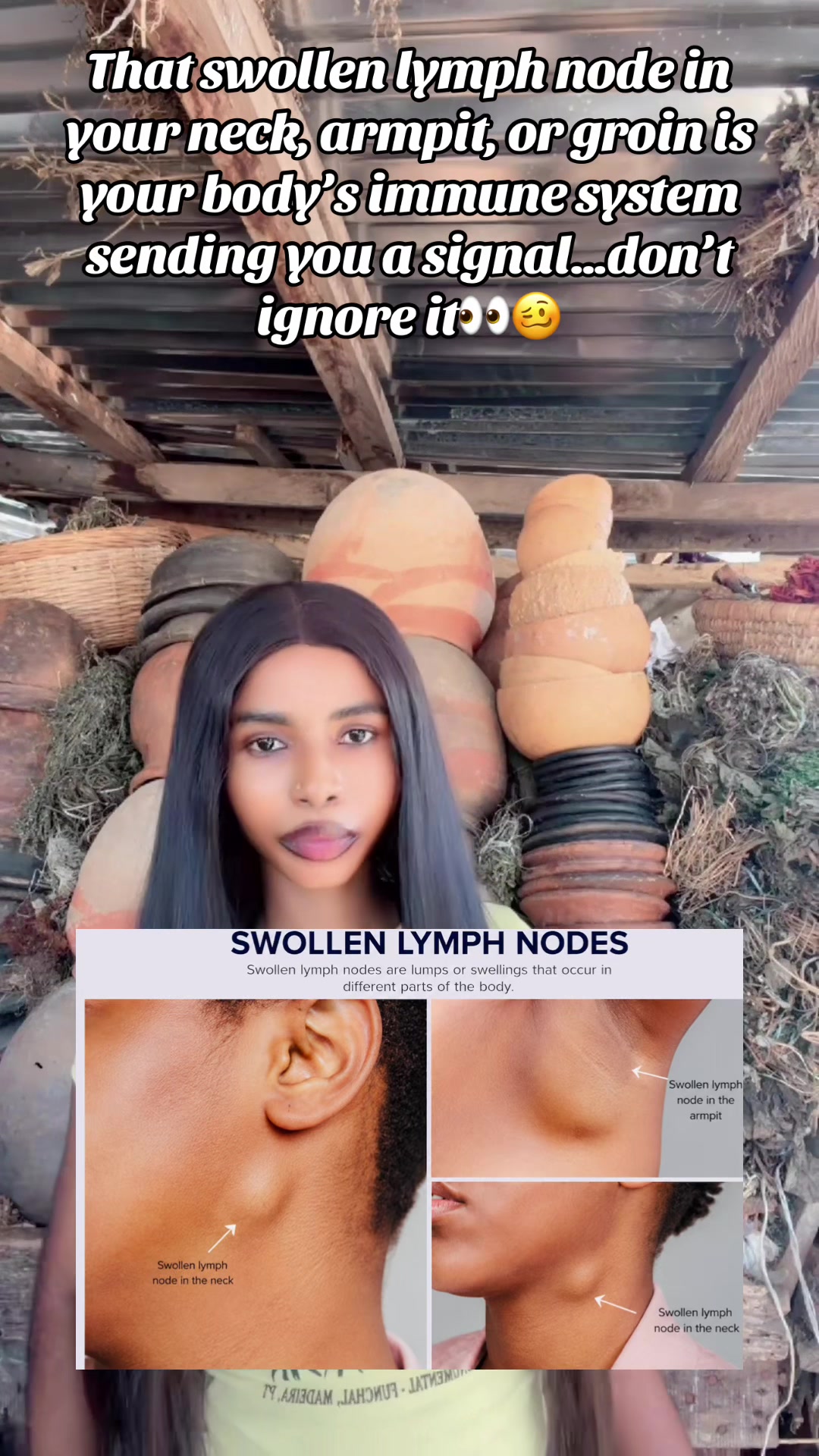 @GeNz_alagbo🐍🍯