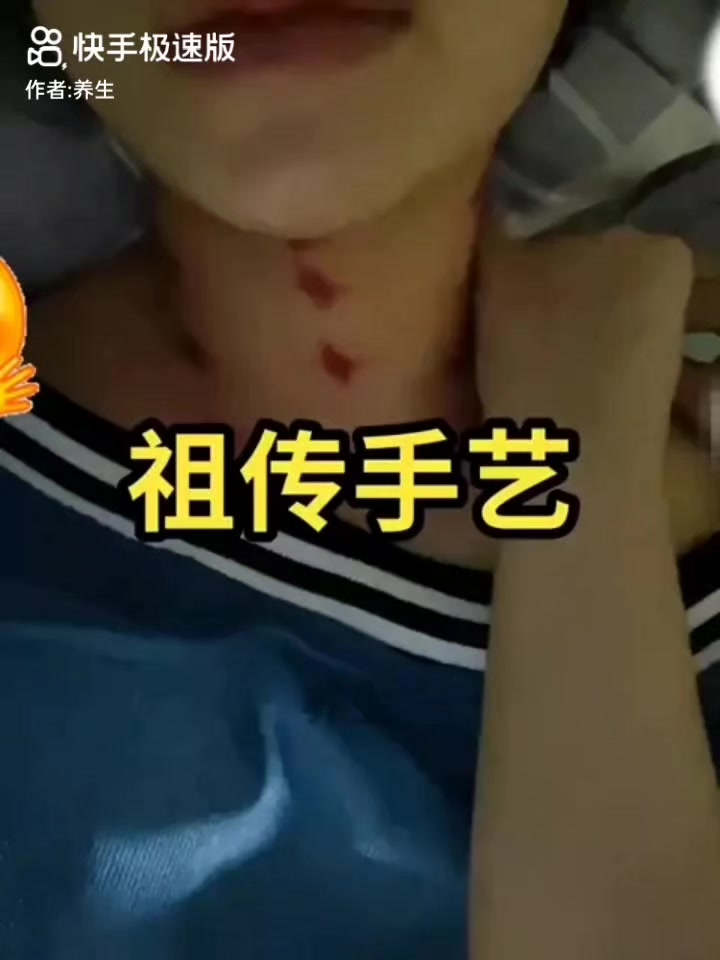 @thích cạo gió