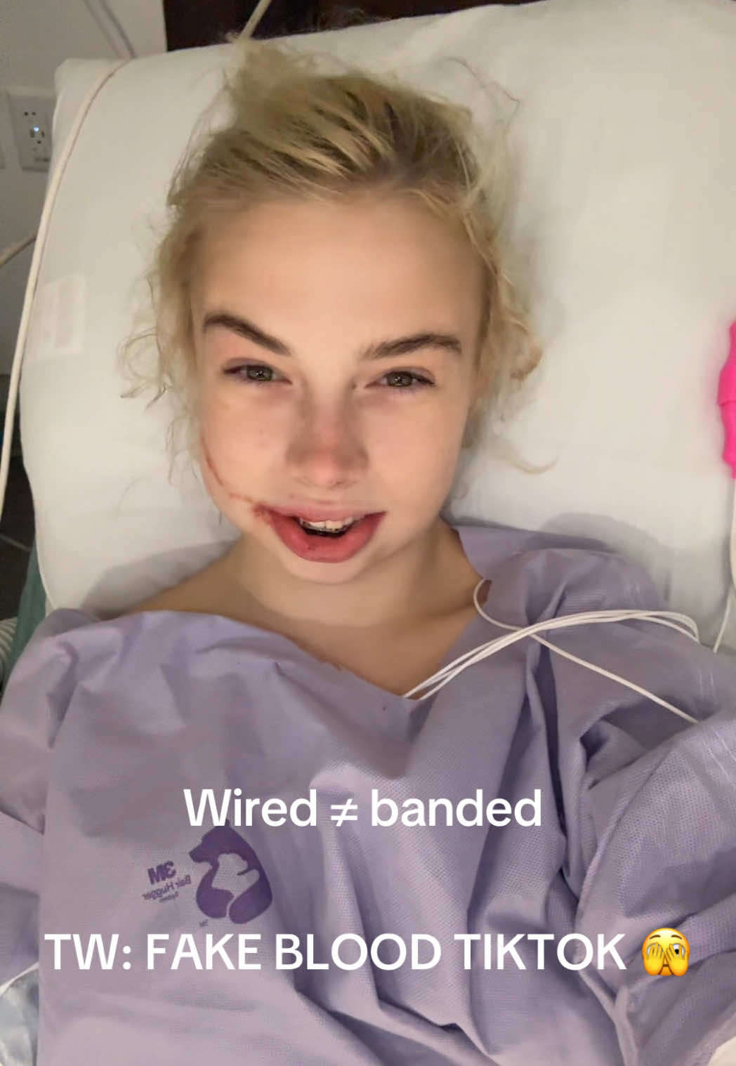 @Aurora Vixen