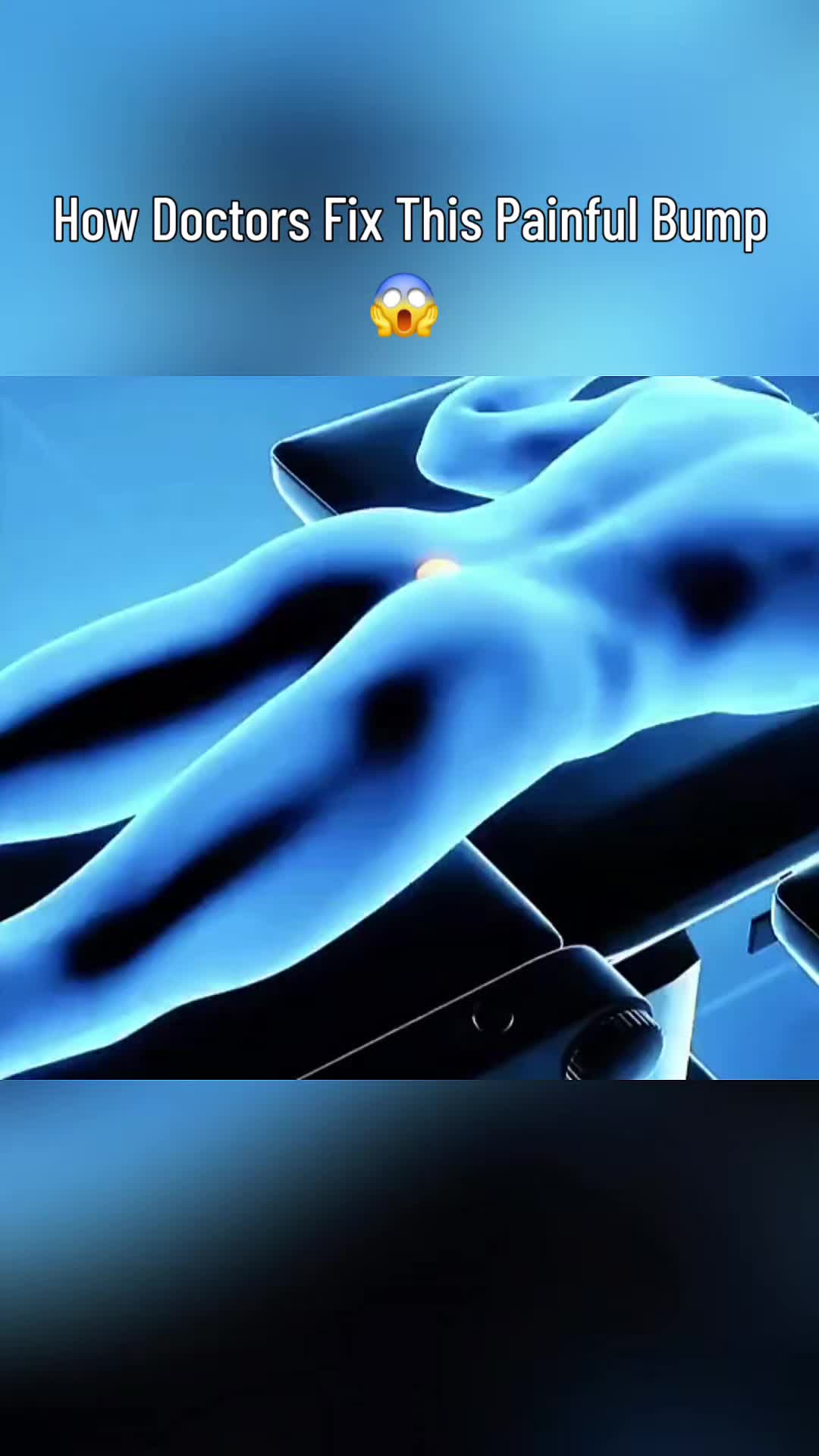 @Secret Body AI