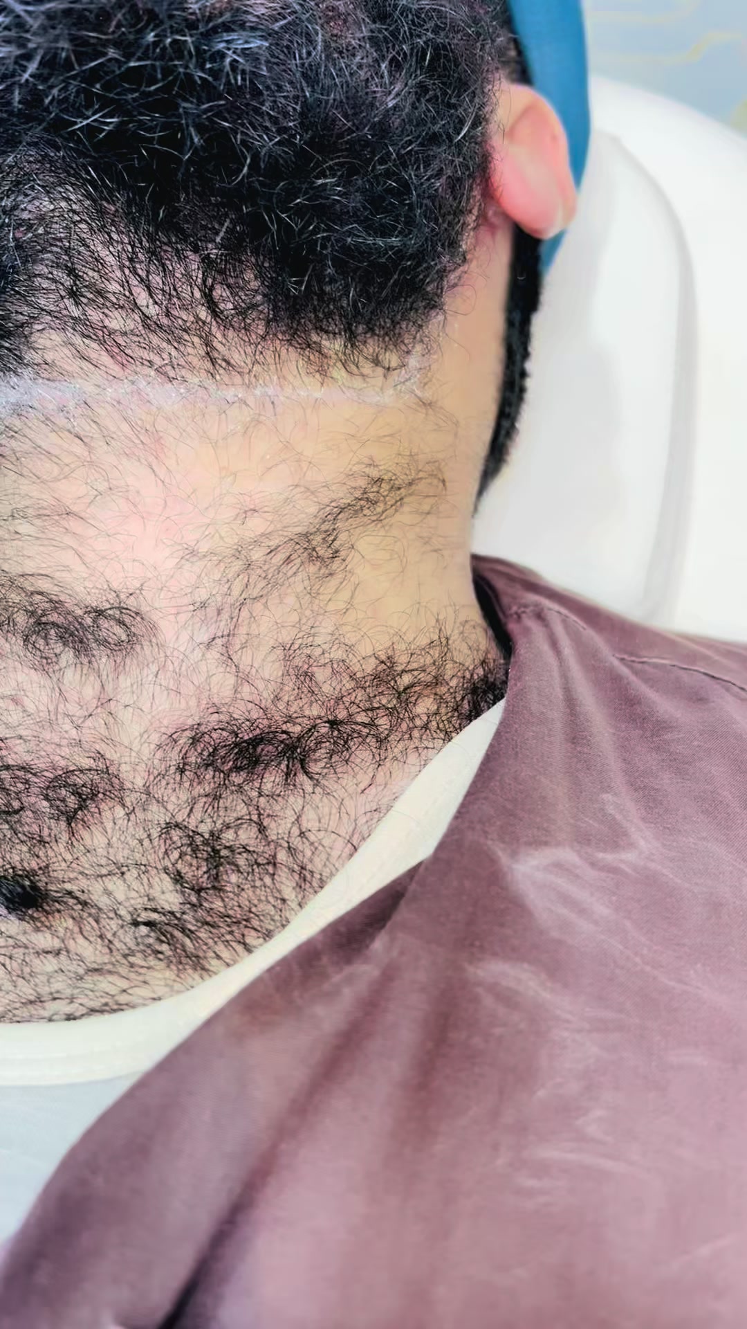 @Laser Grafix clinic