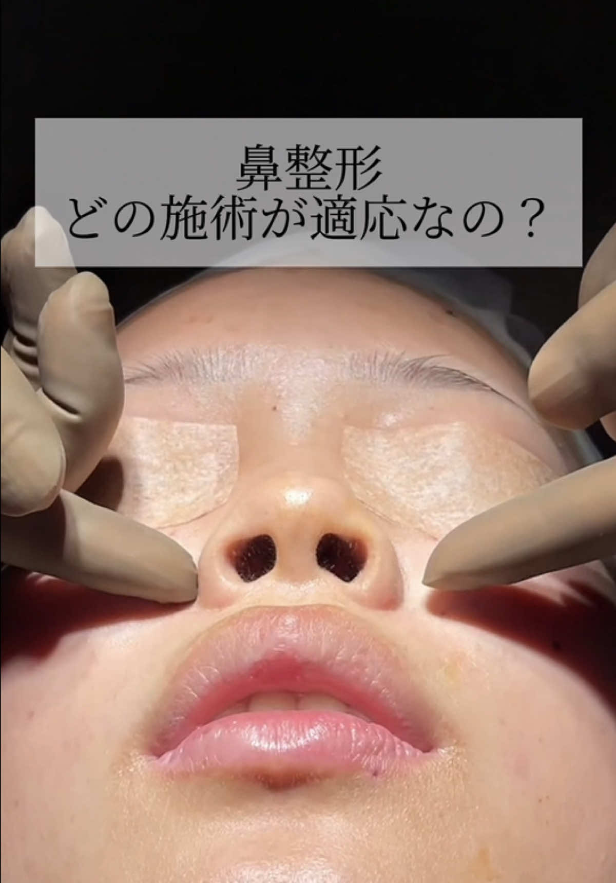 @鼻整形R Beauty CLINIC 副院長👨&zwj;⚕️吉田慧