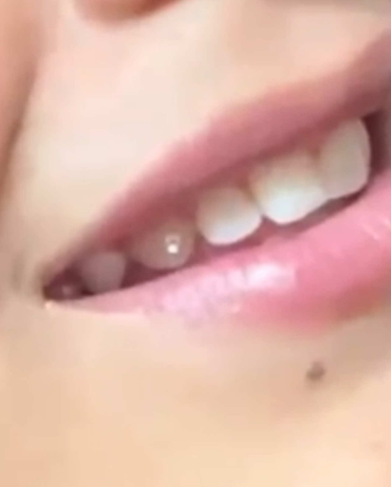 @Smile Dental Studio