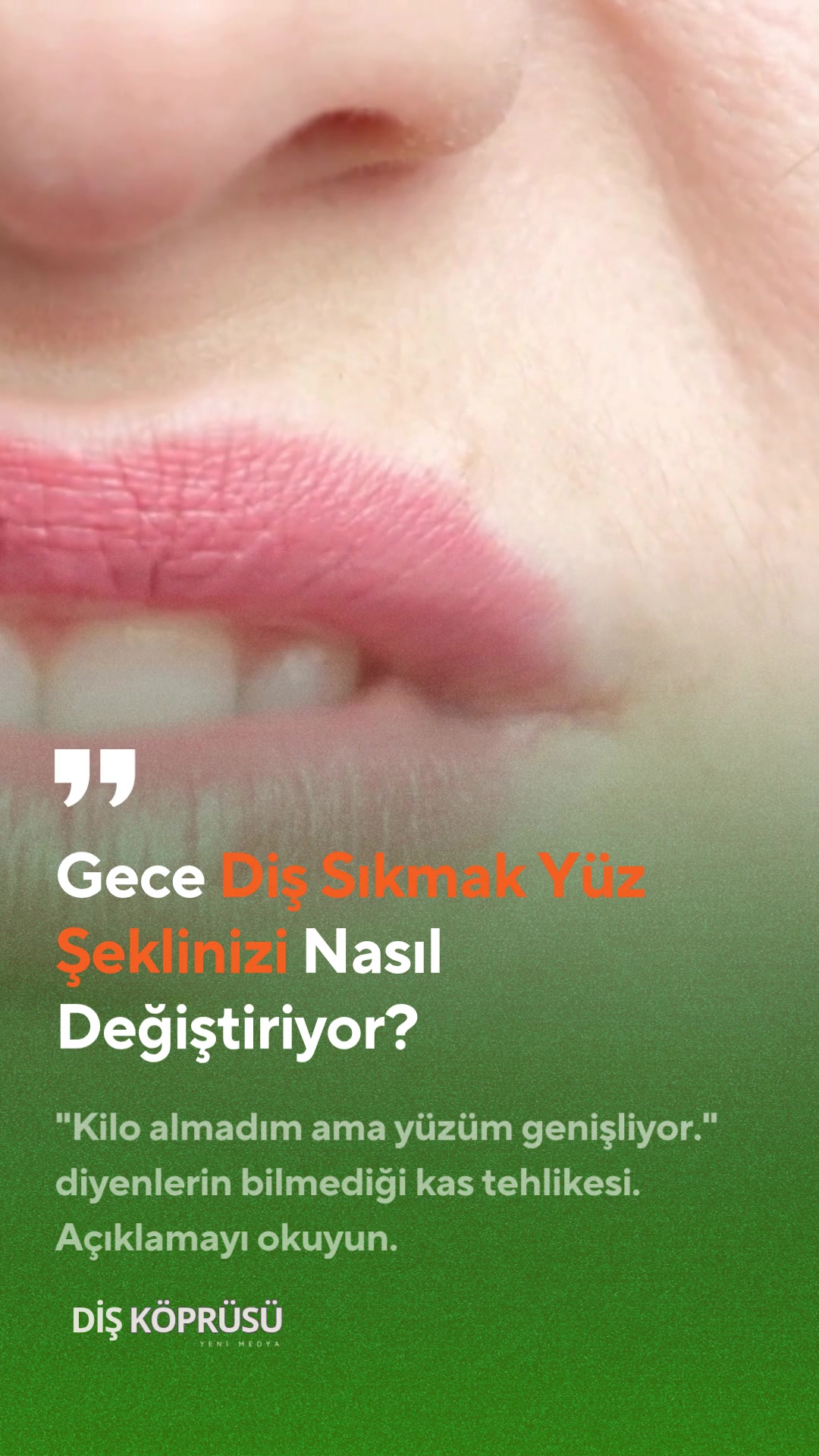 @Diş Köprüsü | Yeni Medya